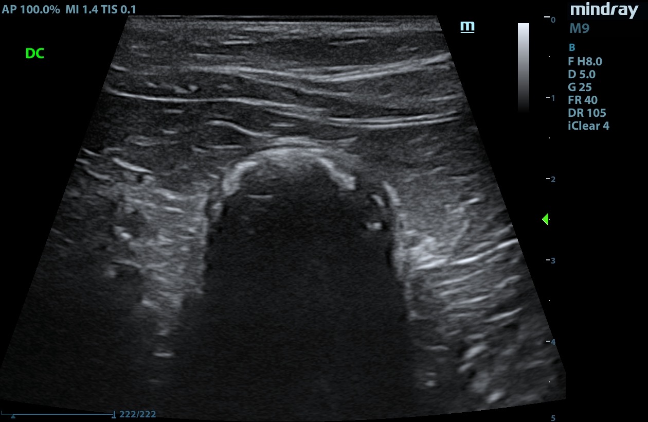 Veterinary ultrasound of a canine abdomen acquired with a high-frequency linear probe
