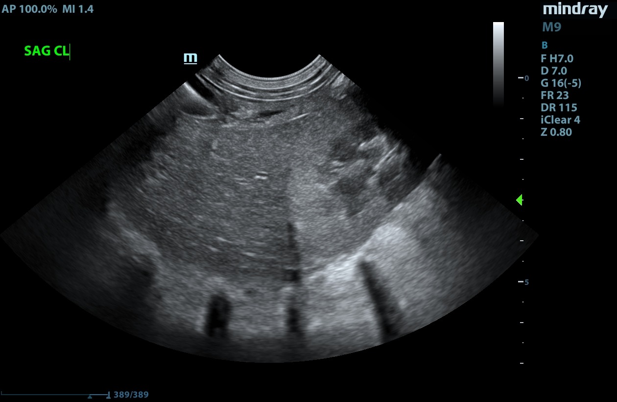 Sagittal veterinary ultrasound of the caudate lobe of a canine liver with the right kidney