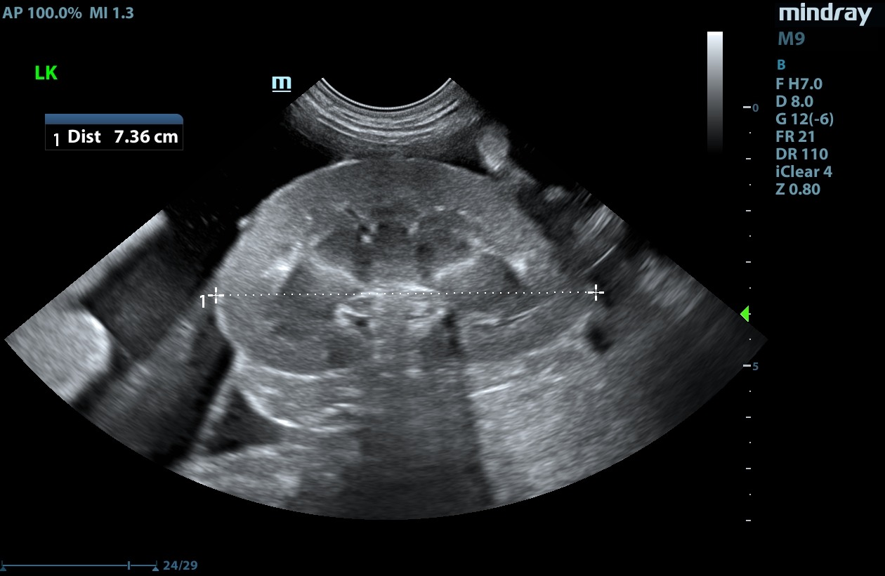 Veterinary ultrasound of a canine left kidney, measured at 7.36 centimetres
