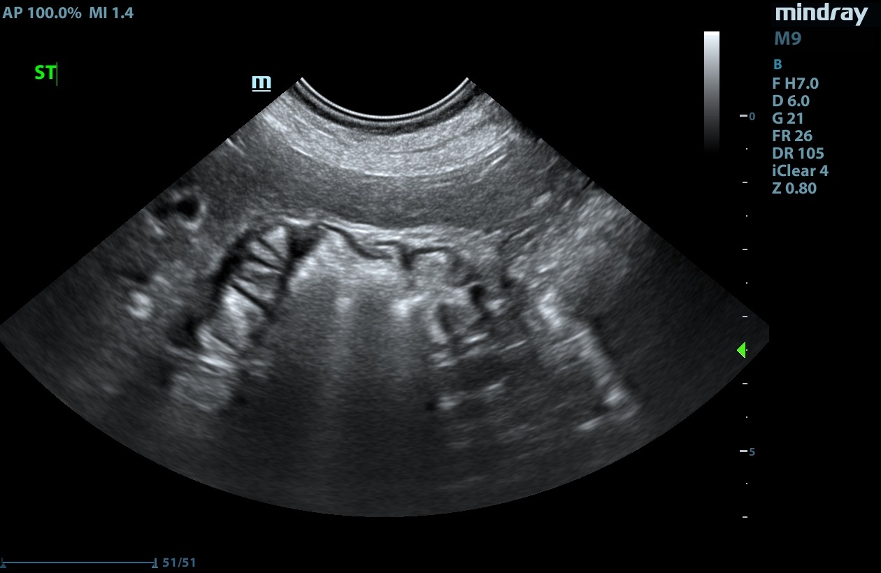 Veterinary ultrasound of a canine stomach